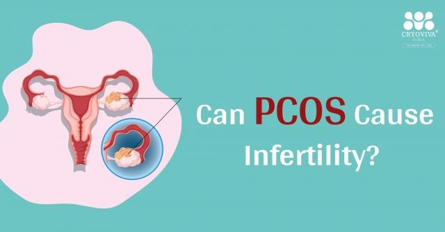 Can PCOS Cause Infertility? Here's What You Should Know